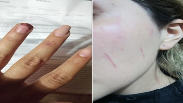 En Morelia: Mujer denuncia agresión por parte de otra en plena vía pública