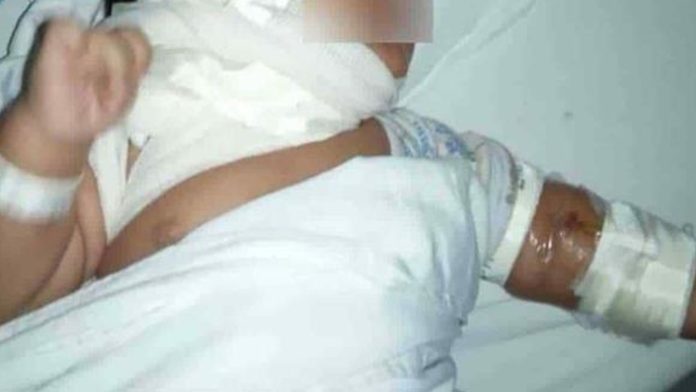México: Cohetón le explota a bebé de un mes; le causa graves quemaduras