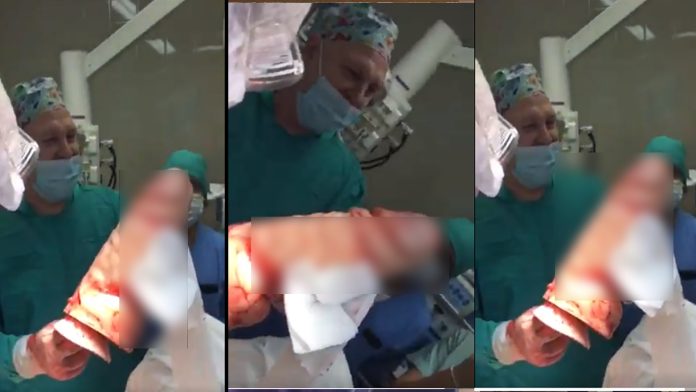 Video: Va al doctor por dolor de estómago; lo operan y encuentran consolador gigante