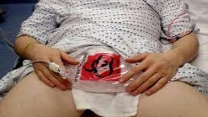 Mujer le muerde el miembro a su novio porque pensó que le quería ser infiel