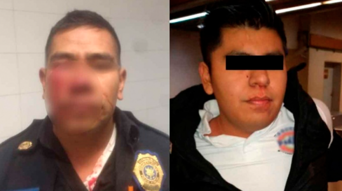 Arranca la nariz de un policía por que no lo dejó orinar en el Metro