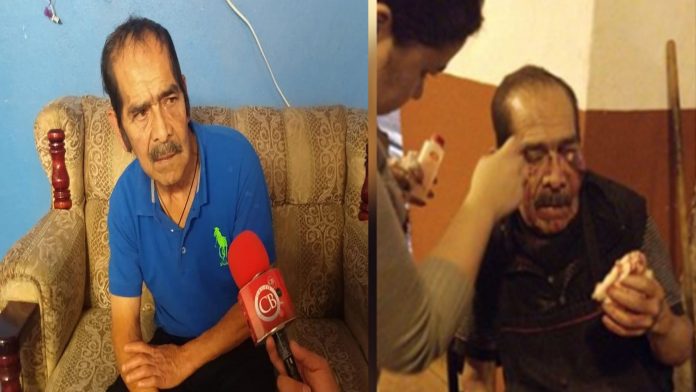 Don “Meño” regresa a trabajar tras haber sido agredido por estudiantes