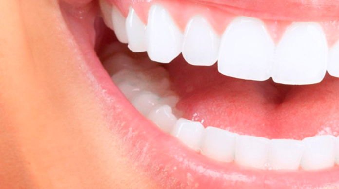Entre los 20 y 30 años se presenta la mayor pérdida de piezas dentales