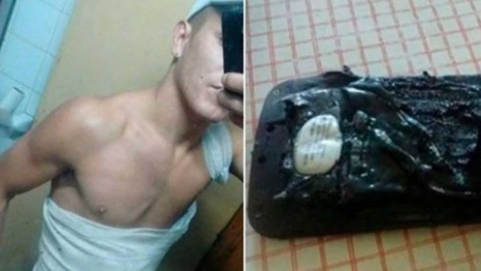 Le explotó el celular mientras dormía: “Me desperté en llamas”