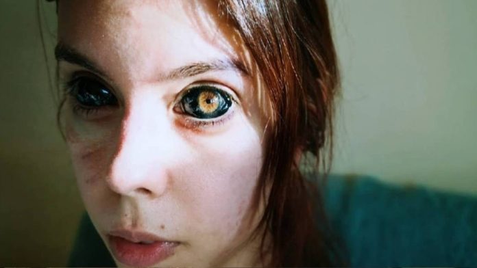 Una modelo de 25 años, identificada como Aleksandra Sadowska, originaria de Polonia, quedó ciega del ojo derecho tras tatuarse los ojos de negro.