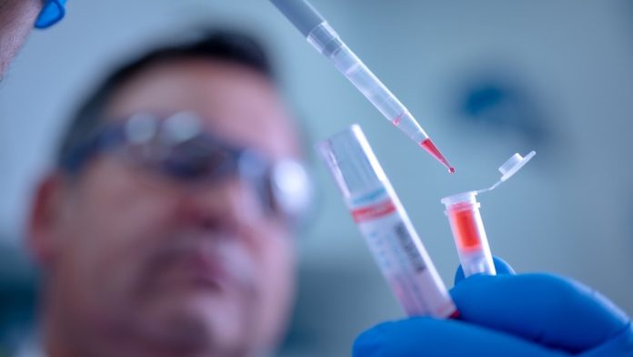 Estos son los laboratorios en los que puedes acudir a hacerte la prueba del coronavirus