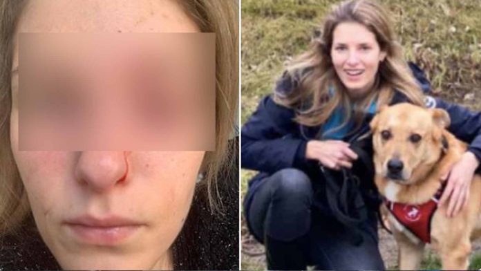 Perro desfigura a su dueña; casi pierde un ojo