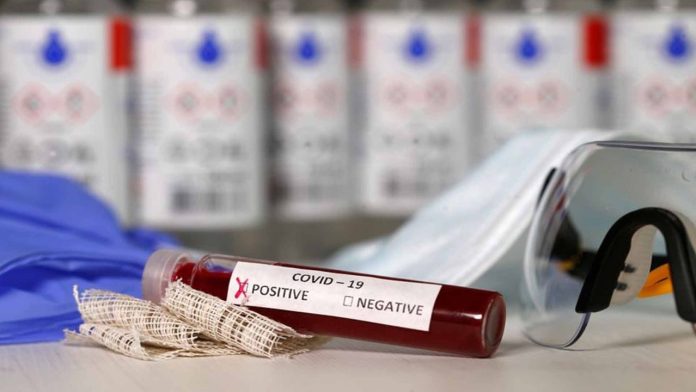 Prueban con éxito terapia de antivirales para COVID-19terapia de antivirales para COVID-19