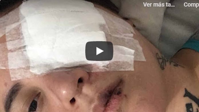 Video:
