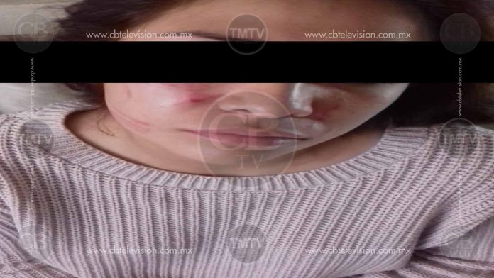 Fémina recibe golpiza a manos de Regidora de Paracho y sus dos hermanas