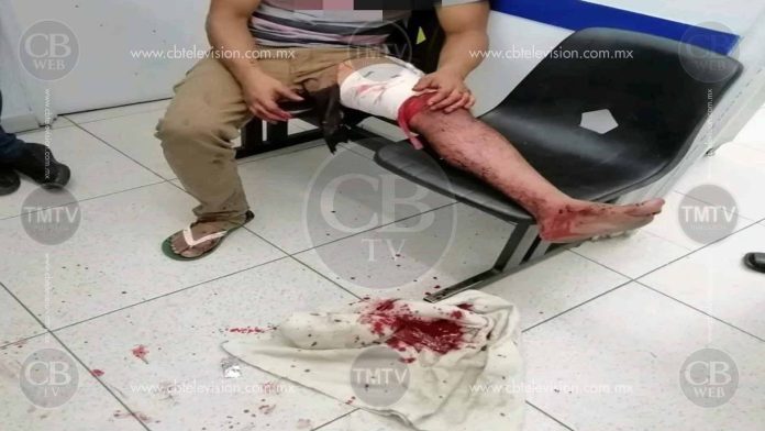 Michoacán: Discute con su mujer y termina acuchillado