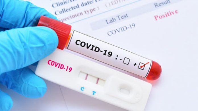 Más del 50% de mexicanos que se realizan prueba de covid-19, son positivos