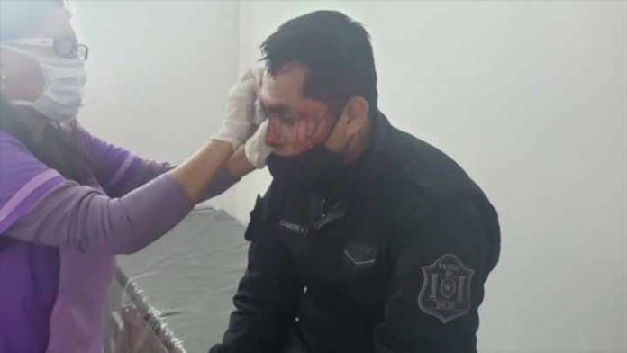 Golpean a policías que pretendían terminar con un partido de fútbol