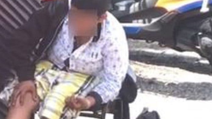Rocían con ácido a joven mujer indigente mientras dormía, peatones la ignoran