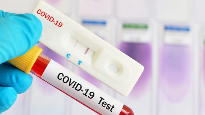 La universidad de Harvard trabaja en pruebas rápidas para el covid