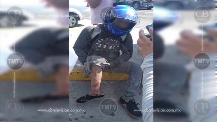 Motociclista se rompe la pierna al chocar con camioneta en Morelia
