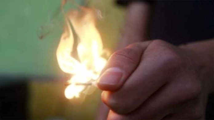 Le prenden fuego a niño de 12 años mientras jugaba en el parque