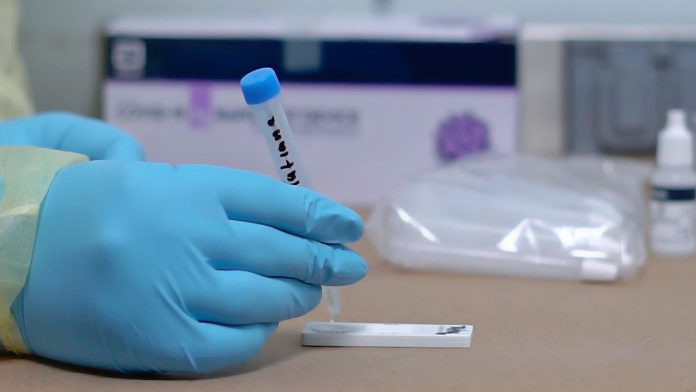 Positivas ocho mil 439 pruebas de antígeno en los Módulos de Enfermedades Respiratorias