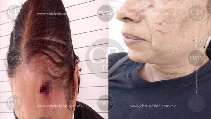 Mujer que fue golpeada con un palo en la cabeza denunciará agresiones de maestros