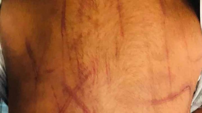 Rescatan a niño de tres años que era golpeado por su madre y su pareja