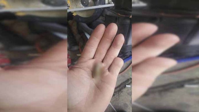 Joven se corta el dedo lo encuentra 6 meses después