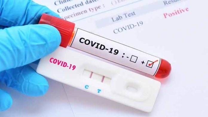En Uruapan, 5 de cada 10 pruebas de Covid-19 son positivas