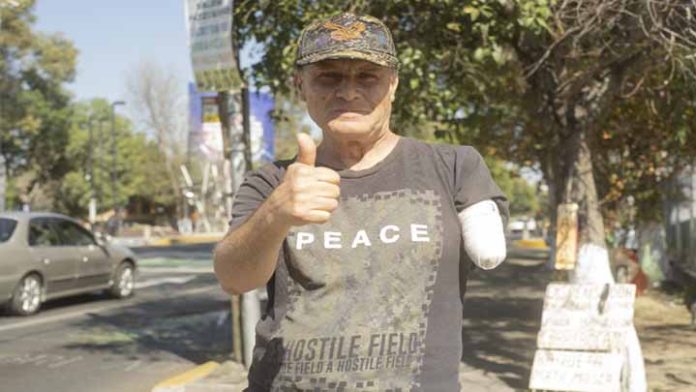 Un accidente le quitó el brazo pero él se mantiene luchando por seguir adelante