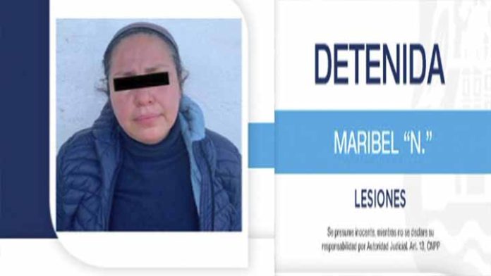 Mujer le rompe la nariz a niña de 12 años “porque se le quedó viendo a su marido”