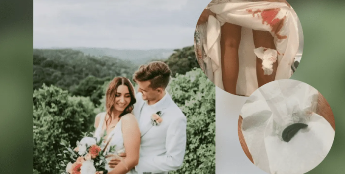 Novia es atacada por sanguijuelas