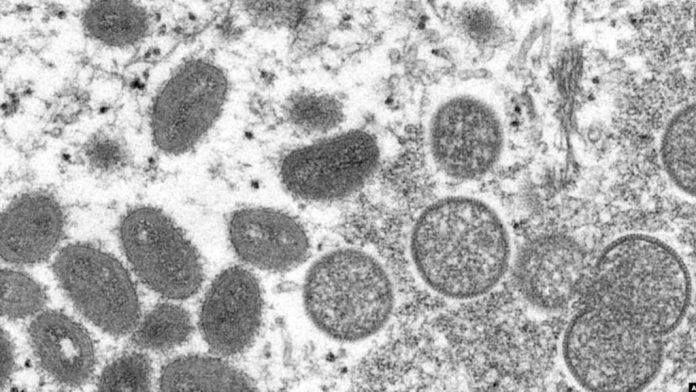 OMS revela que se han registrado 131 casos de Viruela del mono en países no endémicos