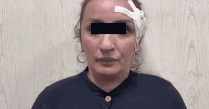 Mujer vende a su bebé para hacerse una rinoplastía con el dinero