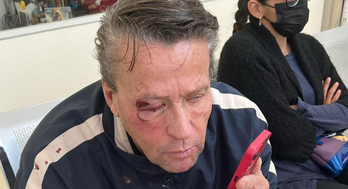 Por intentar grabar balacera, Alfredo Adame es golpeado afuera de su casa