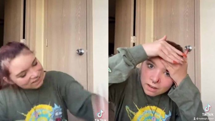 Por hacer reto viral de TikTok, joven se corta la cara