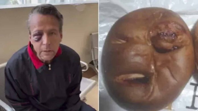 Crean pan de Alfredo Adame inspirado en golpiza que recibió