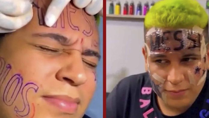 Joven se tatuó ‘Messi’ en la frente; se arrepintió y ahora quiere quitárselo