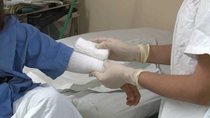 En diciembre, incrementa hasta el 5% atención médica por quemaduras en niños