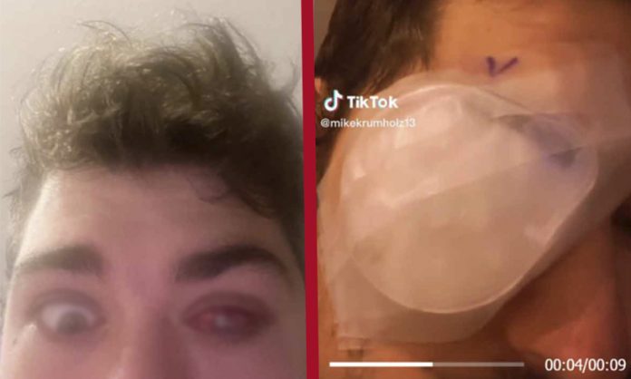 Joven se va dormir con sus lentes de contacto y queda ciego de un ojo