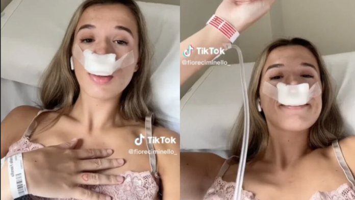Joven se hace rinoplastia para heredar a sus hijos una “linda nariz”