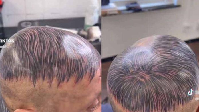 Hombre se tatúa peluquín en la cabeza para disimular la alopecia