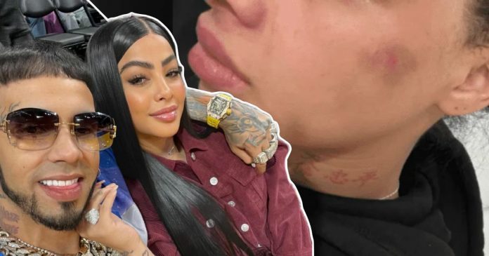 Anuel AA acusado de golpear a ex pareja y ser padre desobligado