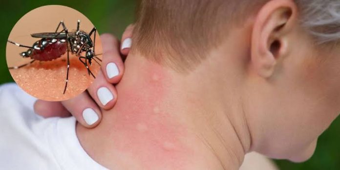 67 casos de dengue en Michoacán. Cero registros de muerte: SSM