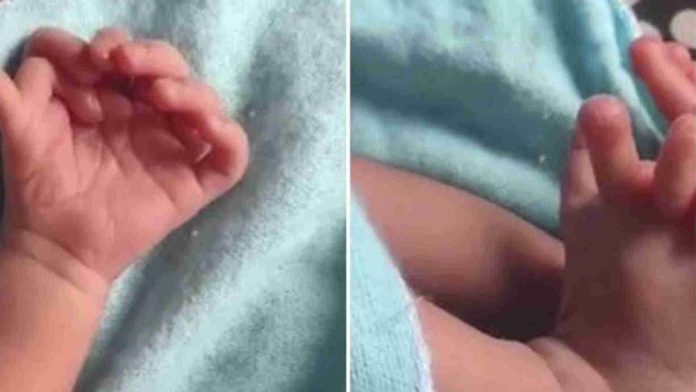 Nace bebé con 26 dedos; afirman que es la encarnación de una diosa hindú