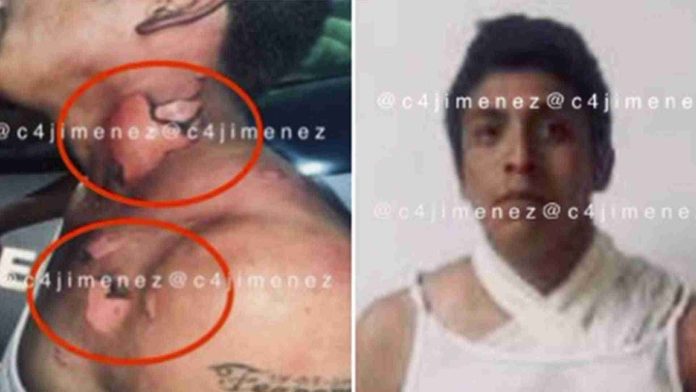 Intentan quemar vivo a un hombre por asaltar a una mujer