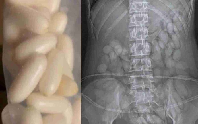 Mujer se mete 63 'balas' de cocaína y la descubren