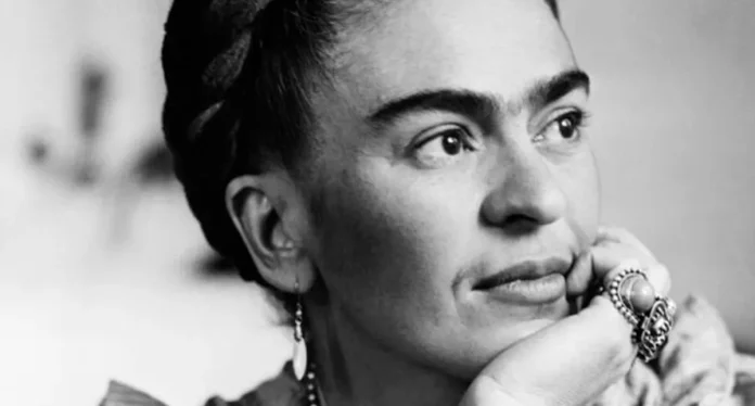 Diagnostican un síndrome de Frida Kahlo 70 años después