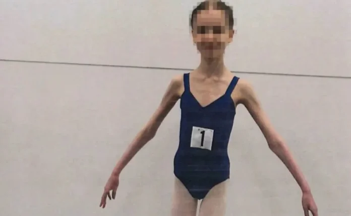 Encarcelan a una pareja australiana por torturar a su hija