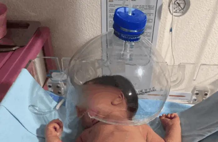 Usan botella de plástico para oxigenar a bebé en hospital de Tabasco