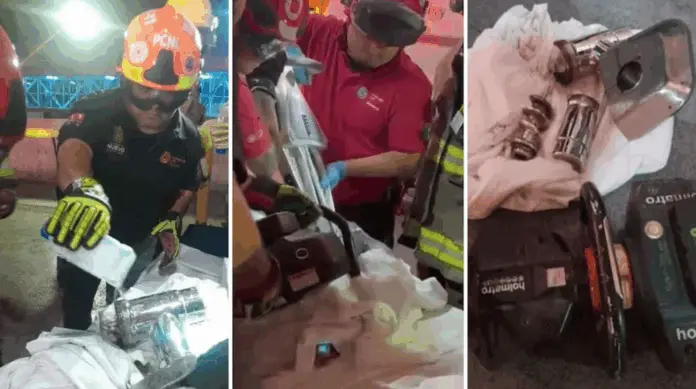 Bebé pierde la mano en accidente con máquina moledora de carne