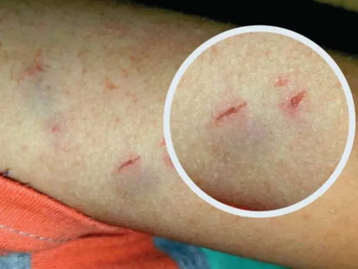 Maestra agrede a un niño clavándole las uñas
