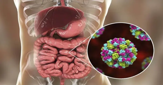 La clínica municipal de Morelia, ha detectado tres casos de Rotavirus